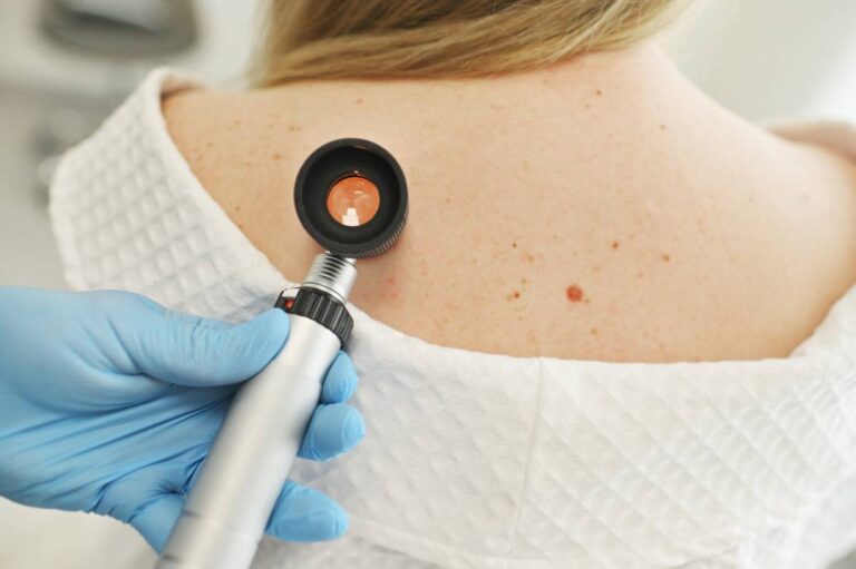 a dermatologist examines moles and skin growths on the patient's body.