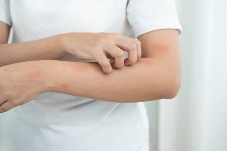 Woman scratches body due to itchy skin.