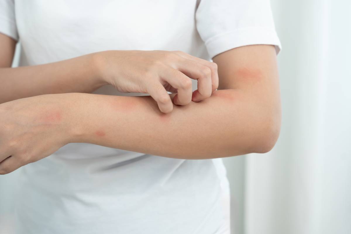 Woman scratches body due to itchy skin.